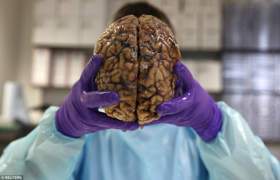 The brain bank at Imperial College London is the biggest in the UK - it <a href=